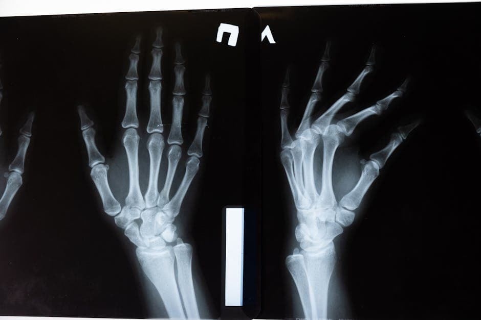 Best Orthopedic Doctor in Ranchi – Dr. MD Arif | Joint & Bone Specialist