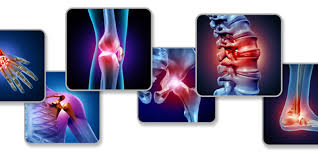 Orthopaedic Myths Busted: What You Should Know